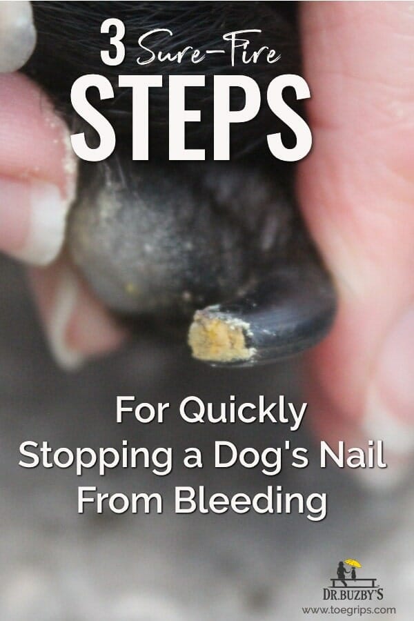 dog's toenail and title 3 sure-fire steps for quickly stopping a dog's nail from bleeding 