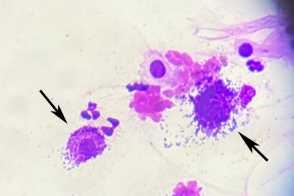 Cytology of mast cells from an aspirate.