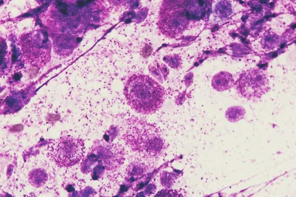 Microscopic image of mast cells