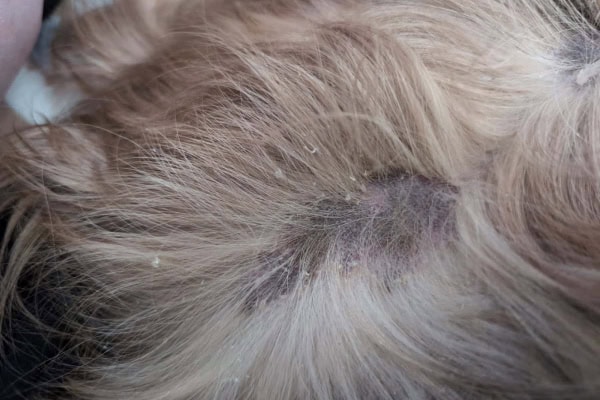 Dandruff in a dog caused by infection