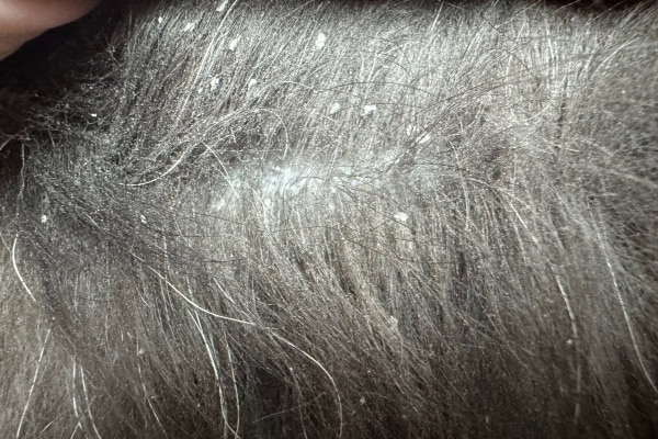 Dandruff in the hair of a dog