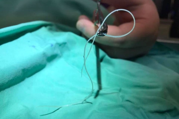 Veterinary surgeon's hand with hemostats holding a heartworm extracted from a dog's heart.