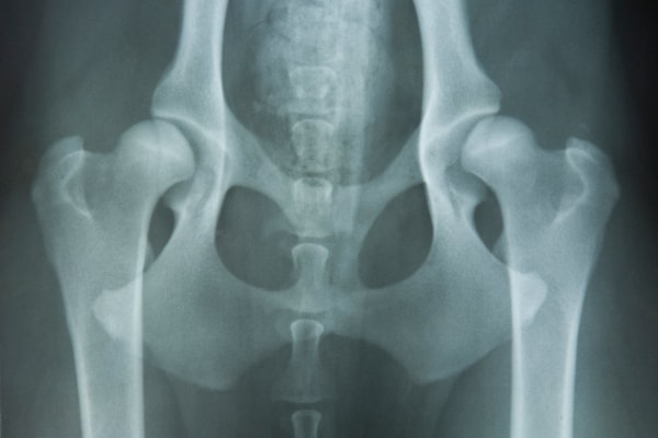 Radiograph of a dog's pelvis showing bilateral hip dysplasia, photo