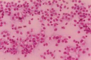 Histiocytoma Vs. Mast Cell Tumor in Dogs - Dr. Buzby's ToeGrips for Dogs