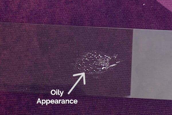 An arrow and the words "oily appearance" written next to a lipoma aspirate taken from a dog's lipoma  and placed on a slide. 