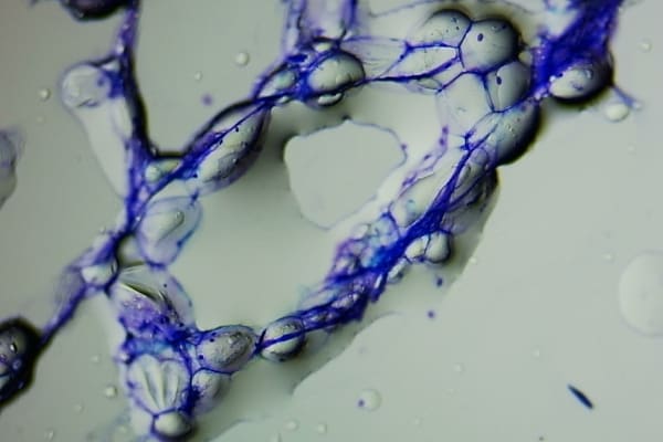 a microscopic view of a canine lipoma showing the fat cells
