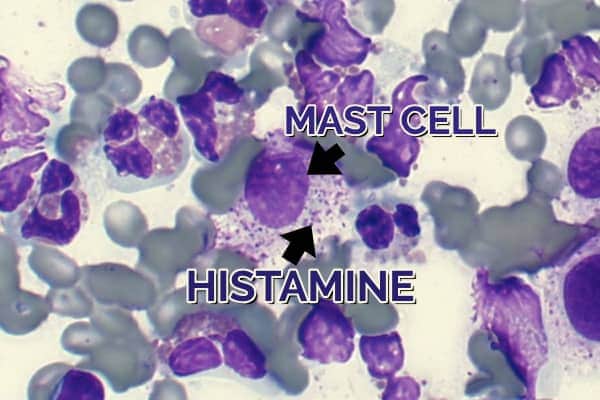 A microscopic view of mast cells and histamine