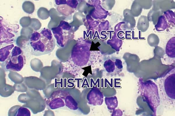 bild av mastceller och histamin