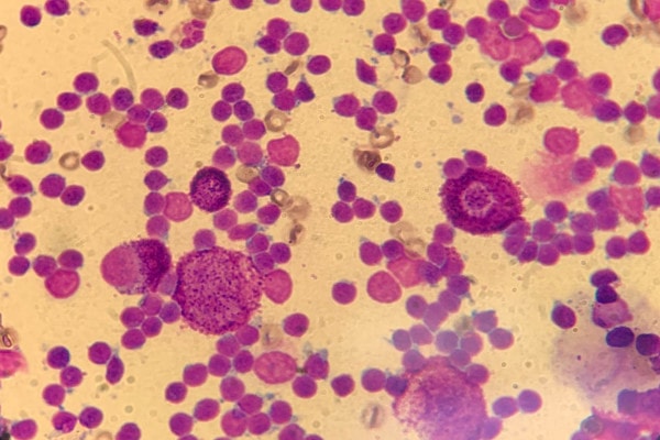 microscopic view of multiple mast cells 