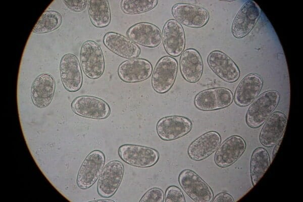 hookworm eggs as viewed under a microscope. photo. 