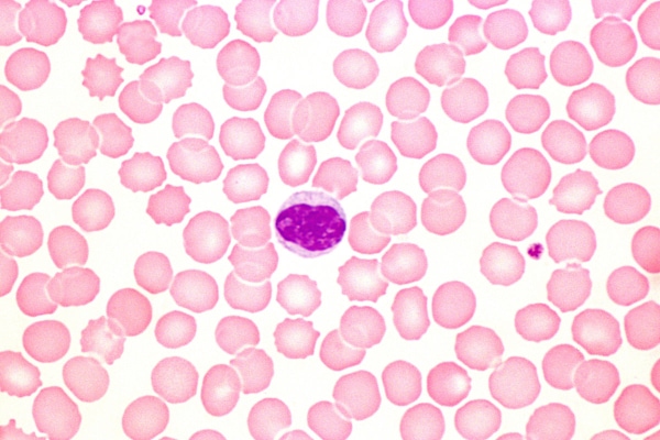 Blood smear with a white blood cell and platelet