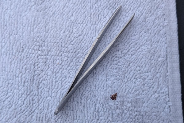 Tweezers next to a tick