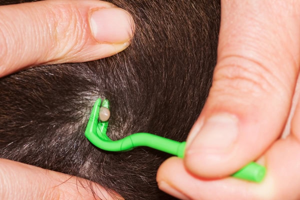 Owner removing a tick from a dog using a tick removal tool