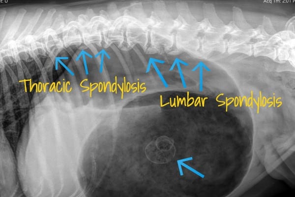 x-ray showing thoracic spondylosis and lumbar spondylosis
