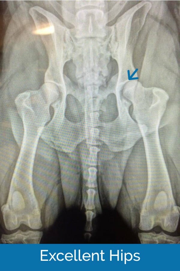 hip dysplasia normal hip xray